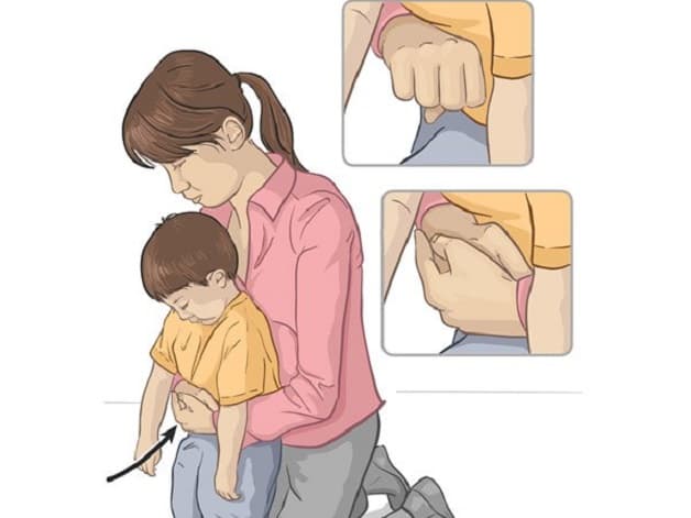 Hóc dị vật gây khó thở