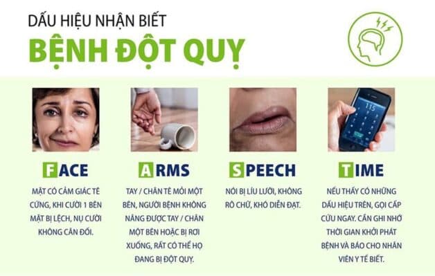 Nguyên tắc FAST trong phát hiện đột quỵ