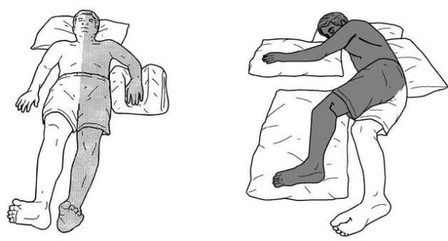 Tìm hiểu về vật lý trị liệu sau tai biến mạch máu não