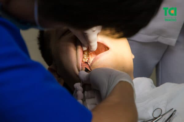 Quy trình loại bỏ răng số 9