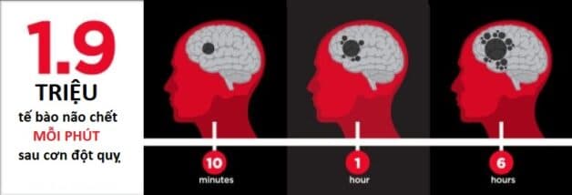 Hiểu về giờ vàng cấp cứu trong tai biến mạch máu não