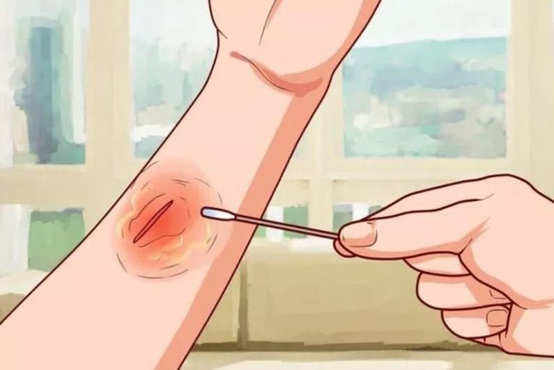 Vi khuẩn uốn ván có thể tấn công mẹ bầu thông qua những vết thương hở và qua quá trình sinh nở