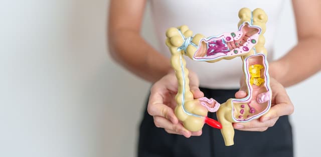 Tìm hiểu triệu chứng của viêm ruột kích thích