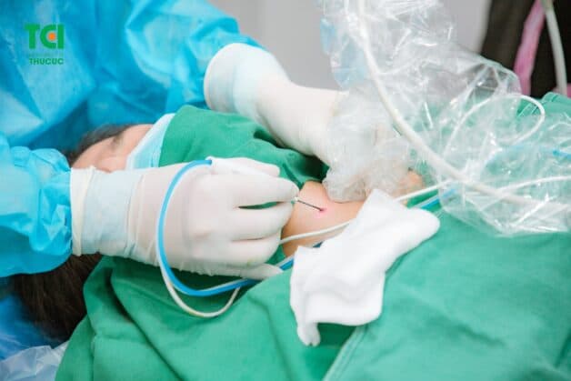 Điều trị u nang tuyến giáp đa nhân tại Thu Cúc TCI.