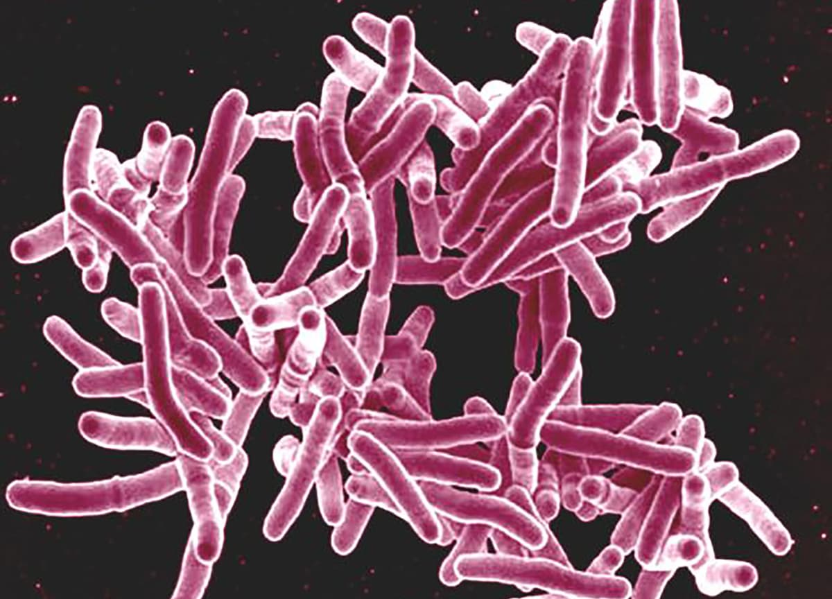 Vắc xin BCG được tạo ra từ một dạng yếu đi của vi khuẩn gây bệnh lao (Mycobacterium tuberculosis)