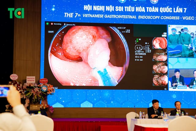 Ảnh Sự kiện Nội Soi Tiêu Hoá Toàn Quốc lần 7