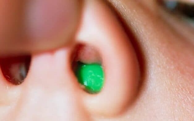 Dị vật vào mũi trẻ: nguyên nhân và cách xử trí an toàn, hiệu quả-1