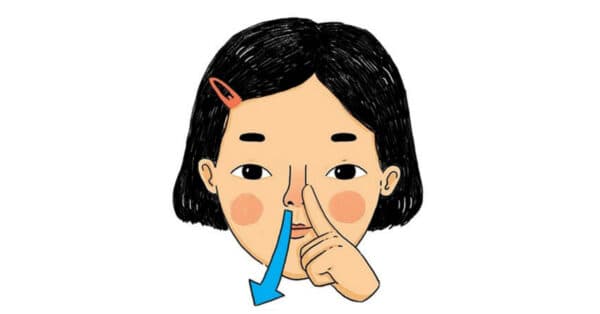 Dị vật vào mũi trẻ: nguyên nhân và cách xử trí an toàn, hiệu quả-2