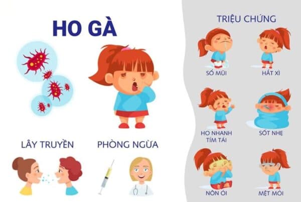 Triệu chứng bệnh ho gà ở trẻ sẽ xuất hiện dần theo giai đoạn của bệnh