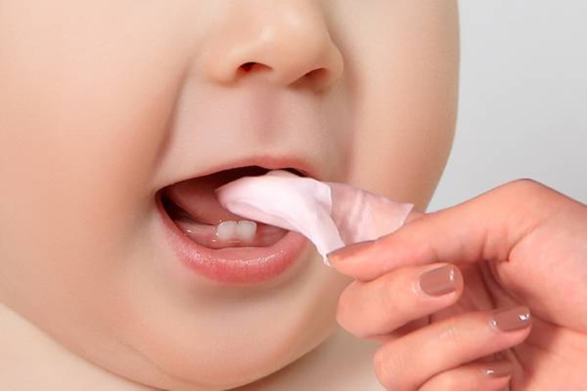 Tình trạng bé 1 tuổi sâu răng và lời khuyên cho cha mẹ