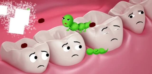 Bệnh sâu răng &#8211; Phòng ngừa và điều trị