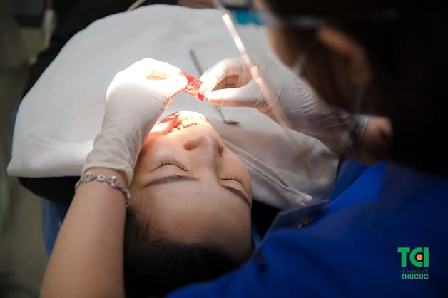 bọc răng sứ giúp khôi phục thẩm mỹ cho những chiếc răng bị sâu, mẻ, vỡ...