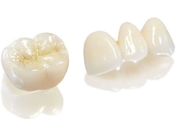 Mão toàn sứ không chứa bất cứ thành phần nào từ kim loại