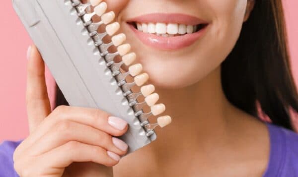 Khái quát chung về bọc răng sứ Mỹ