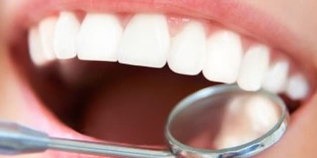 bọc răng sứ cho 4 răng cửa bị hô