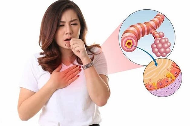 Các bệnh lý hô hấp thường gặp lúc giao mùa