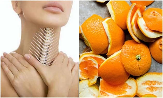 Nhiều mẹo truyền miệng chữa hóc xương cá