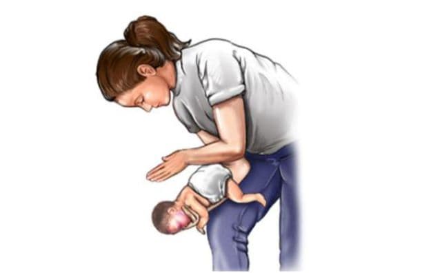 Hình minh họa cách sơ cứu cho trẻ dưới 2 tuổi