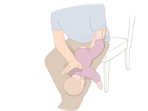 Cách xử lý hóc dị vật đường thở ở trẻ dưới 2 tuổi: Phương pháp vỗ lưng ấn ngực.