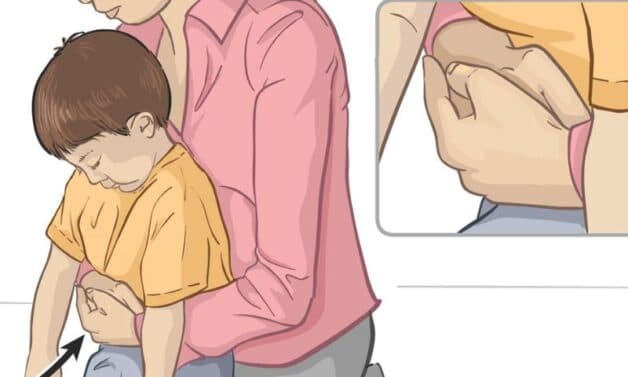 Cách xử lý hóc dị vật đường thở ở trẻ trên 2 tuổi: Phương pháp Heimlich