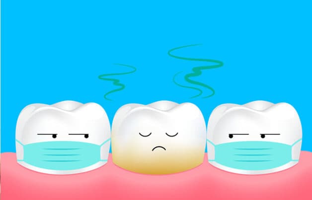 Cạo vôi răng giá sao