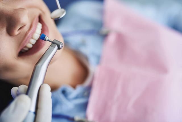 Ưu điểm của cạo vôi răng siêu âm