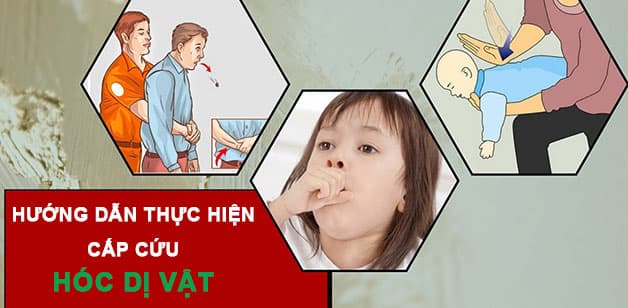 cấp cứu hóc dị vật là thủ thuật cần thiết với những tình huống hóc nguy hiểm
