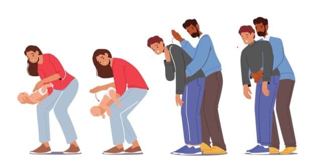 Thủ thuật Heimlich cấp cứu hóc dị vật