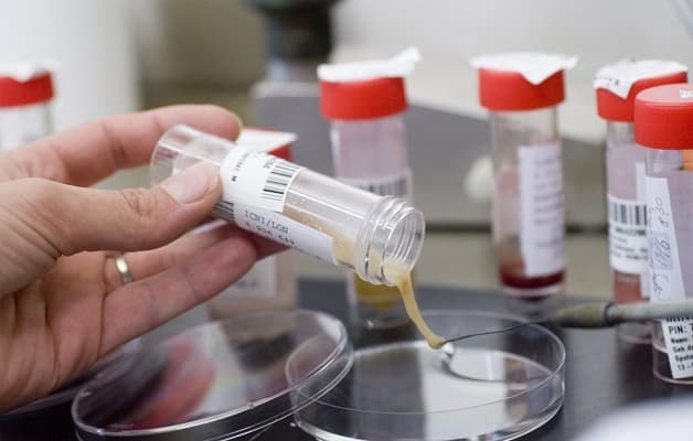 Mẫu đờm thường được thu thập vào sáng sớm, khi người bệnh chưa ăn uống hay sử dụng bất kỳ loại kháng sinh nào.