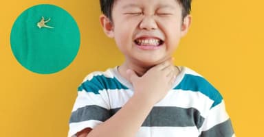 Những điều nên biết để chữa hóc xương cá hiệu quả cho trẻ