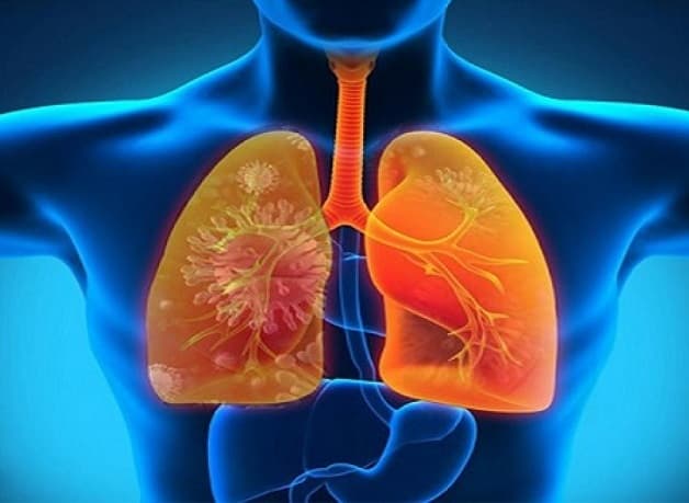 Hậu quả của cúm A/H5N1