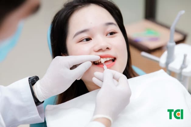 dán phủ sứ răng có tốt không