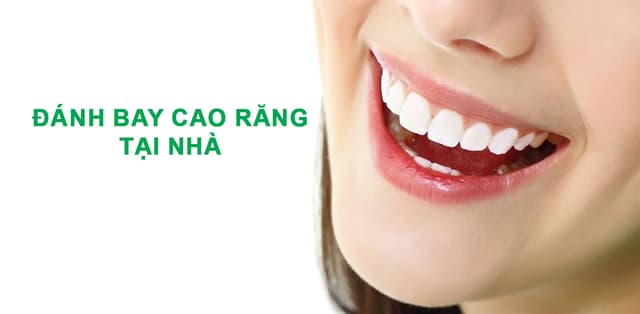Tìm hiểu cách đánh bay cao răng tại nhà hiệu quả