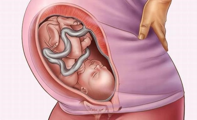 Viêm khớp vùng chậu 