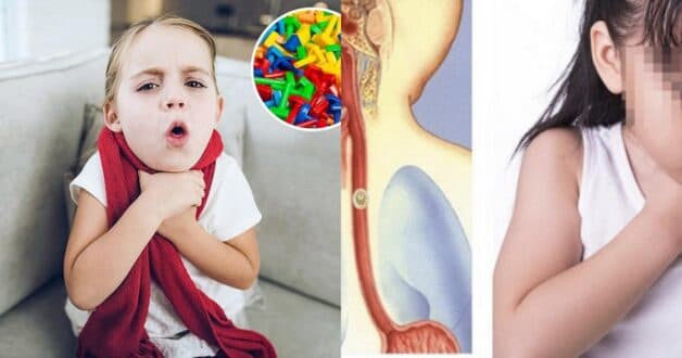 Hình ảnh dị vật trong phổi