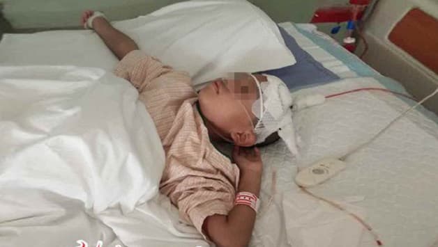 Đột quỵ trẻ em rất nguy hiểm đến tính mạng và sự phát triển sau này của trẻ