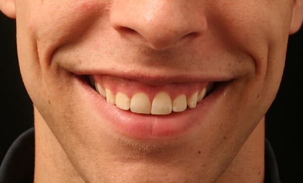 Mỗi phương pháp điều trị khác nhau sẽ có mức giá cao thấp khác nhau