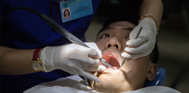 Giới thiệu phương pháp lấy cao răng bằng công nghệ mới