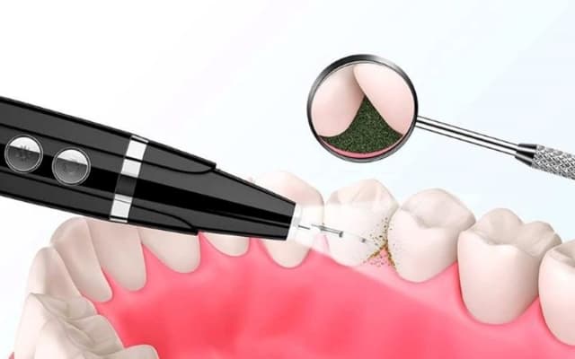 Cách lựa chọn nha khoa lấy cao răng uy tín