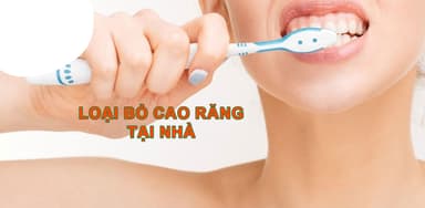 Nha sĩ giải đáp về vấn đề loại bỏ cao răng tại nhà