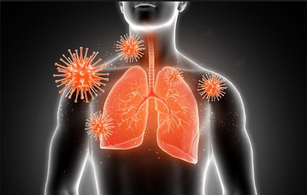 Sự xâm nhập của virus. vi khuẩn là nguyên nhân dẫn đến bệnh đường hô hấp.