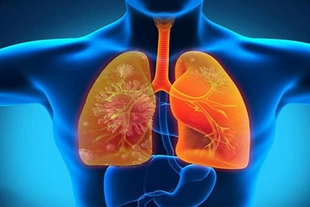 Nguyên nhân gây tình trạng tiết đờm trong cơn ho