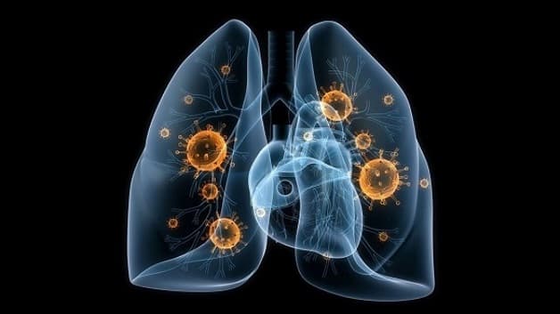 Nhiễm trùng đường hô hấp là gì?