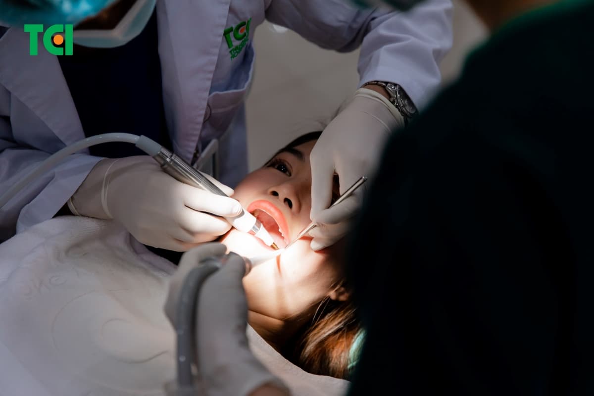 Tình trạng nhổ răng khôn xong có lỗ và những điều cần biết