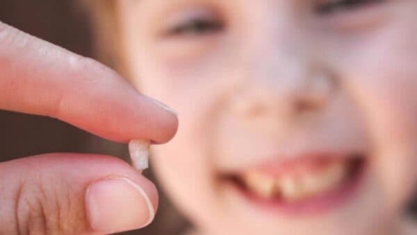 Nhổ răng còn sót chân ẩn chứa những nguy cơ không tốt cho sức khỏe răng miệng của trẻ