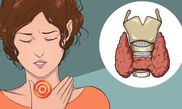 Nhược giáp là khi tuyến giáp không sản sinh đủ thyroxine