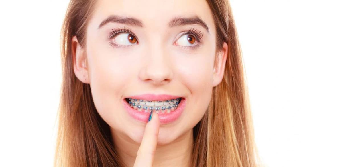 Đi tìm địa chỉ uy tín niềng răng ở Hà Nội