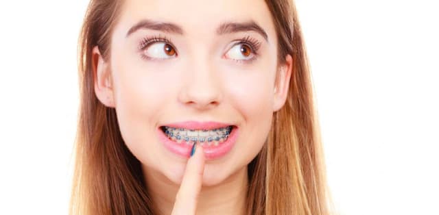 Đi tìm địa chỉ uy tín niềng răng ở Hà Nội