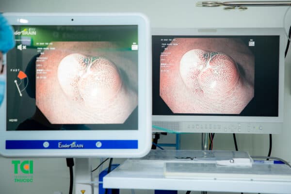 Nội soi phóng đại hàng trăm lần