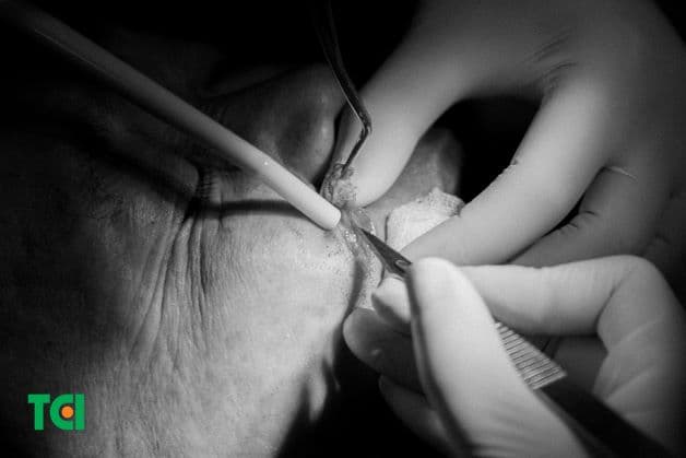 Tìm các cơ sở y tế uy tín để được điều trị triệt để